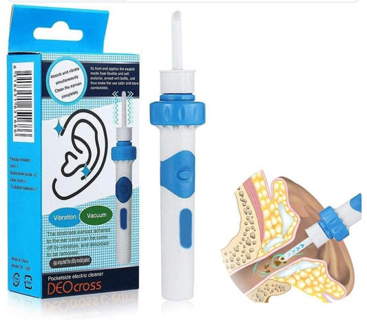 Limpiador de Oídos Eléctrico con Vibración y Vacío