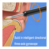 Limpiador De Oídos Con Cámara